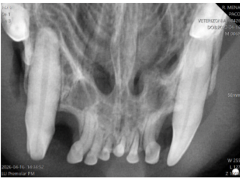 Radiografía intraoral veterinaria con enfermedad periodontal grado 3 en piezas 309 y 409 en gato.